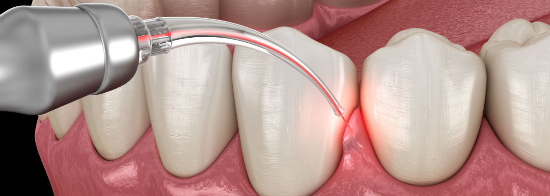 Life Bloom Dental - Powered by Portland's Dentist - Laser Dentistry Header Image